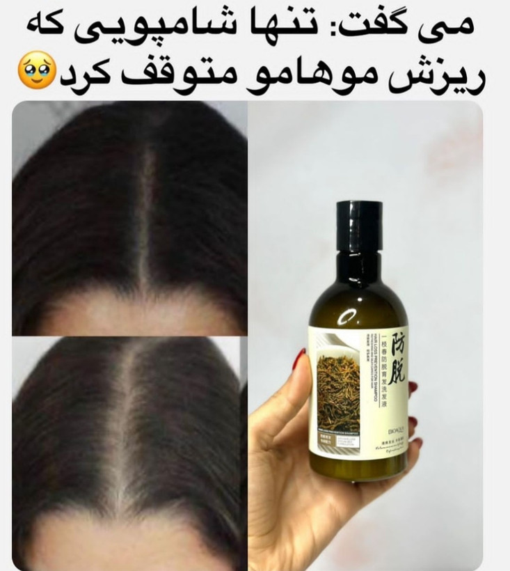 ضدریزش قوی مو فقط نمونه اصلیش