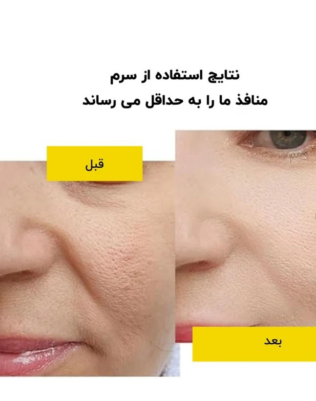 سرم تخصصی منافذ لانبنا ضمانت اورجینال